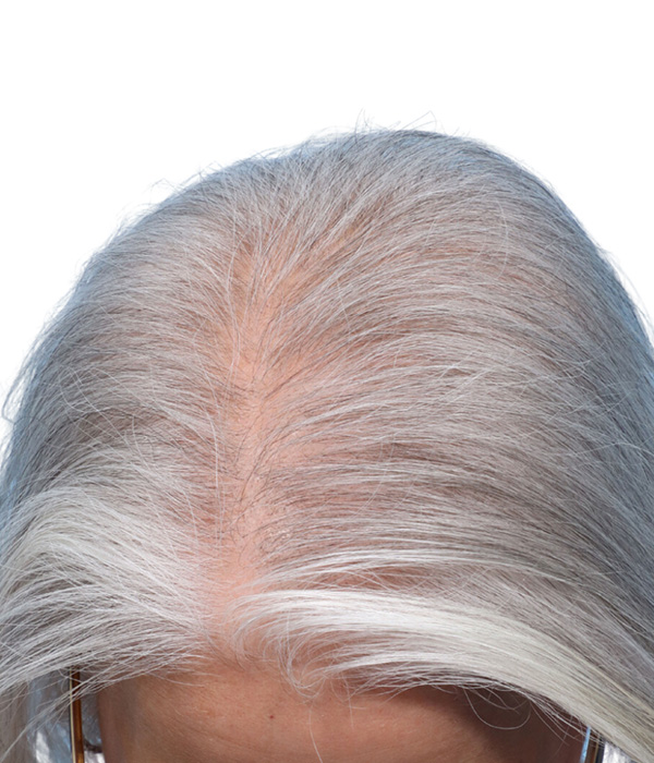 Prp Before and After | Dr. Jeffrey Wise